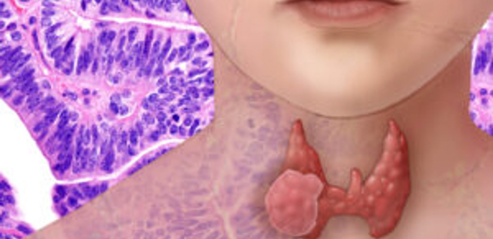 How do you naturally improve thyroid performance?
